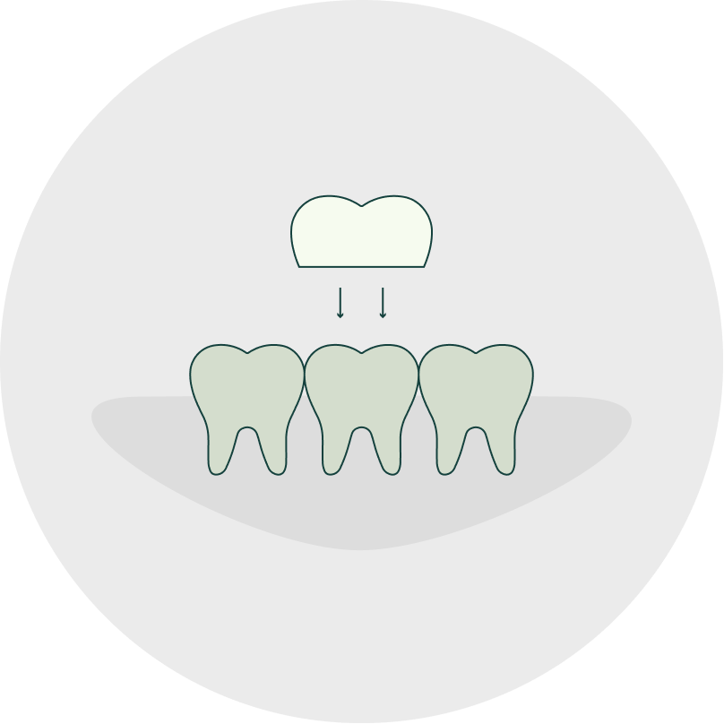 image of teeth crown